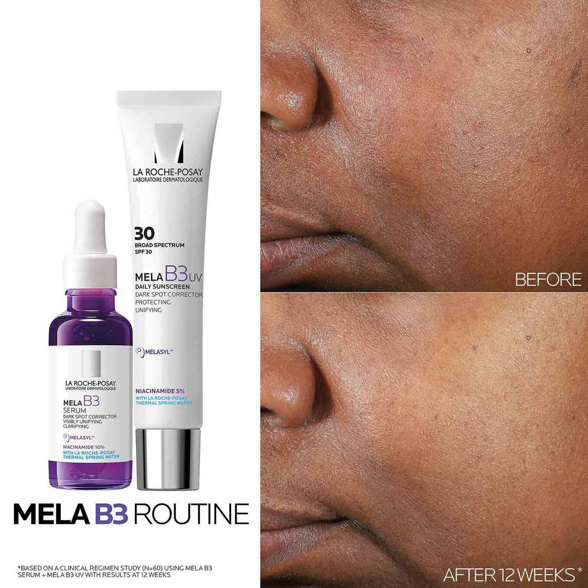 mela-b3-dark-spot-serum-and-mela-b3-uv-daily-moisturizer-with-spf-30-z4 3-Mela-B3-routine_1500X1500.jpg