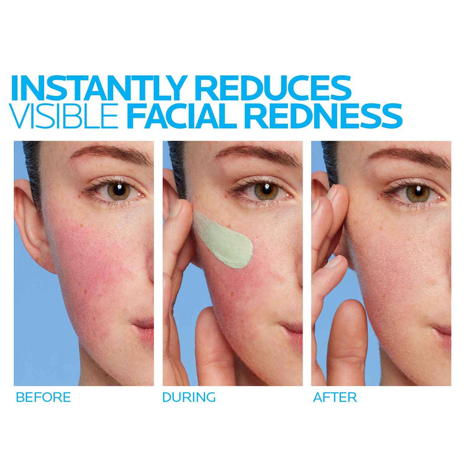 toleriane-rosaliac-ar-face-cream-for-visible-redness-u6 8_Toleriane_Rosaliac-AR-before-after.jpg