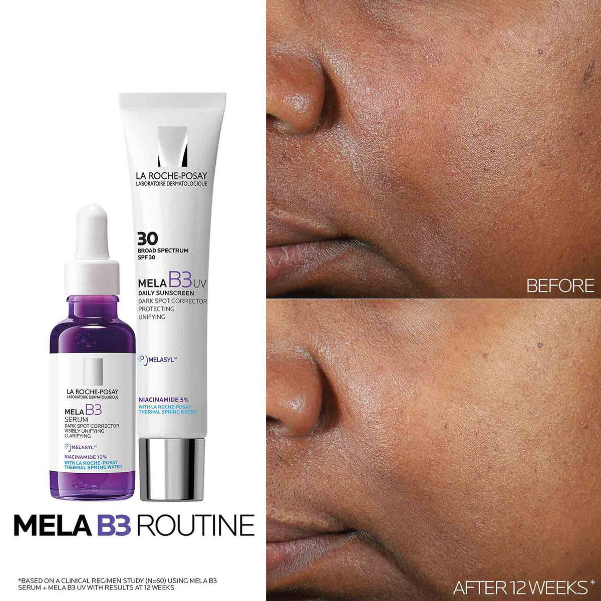 mela-b3-uv-daily-moisturizer-spf-30-with-melasyltm-niacinamide-f9 Mela-B3-routine_1500X1500.jpg